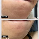 The Ordinary Mariya Fruit Acid Facial Serum Peeling Solution - Image 2